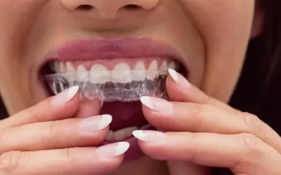 Invisalign Omaha: Clear Aligner Therapy for Discreet Orthodontic Correction